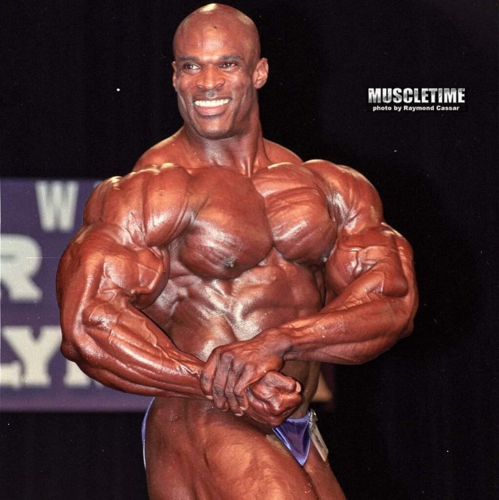 ronnie coleman after bodybuilding