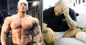 Jeremy Buendia Re-Ruptures Achilles Tendon, Undergoes Surgery, and Announces End of 2024 Contest Season