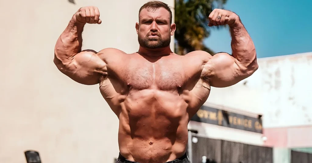 IFBB Pro Bodybuilder Douglas Fruchey Has Died at the Age of 36