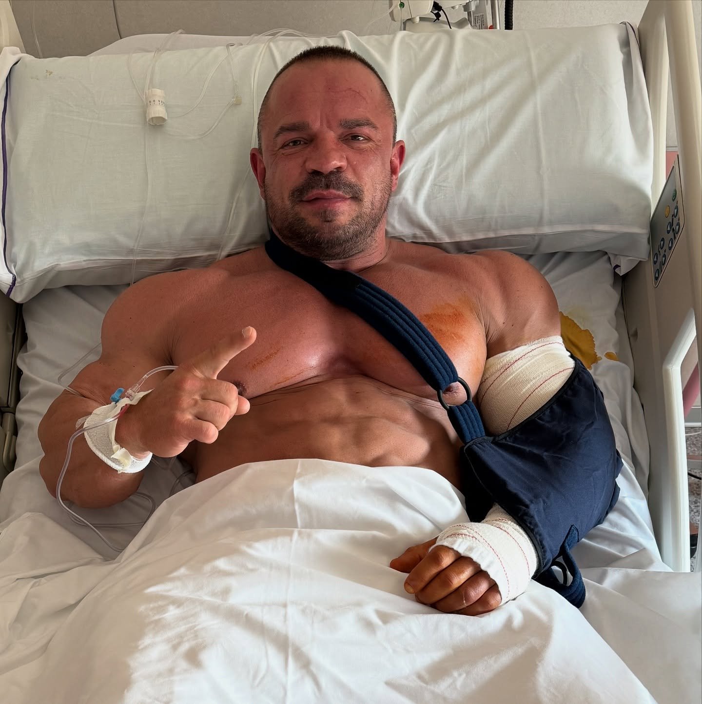 Angel Calderon Frias in a hospital bed with his arm in a sling after triceps surgery in July 2025